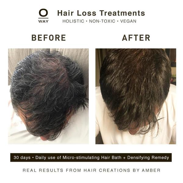 OWAY HAIR LOSS AWARENESS MONTH PACKAGE (20% OFF)